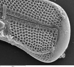 Electron Image 17