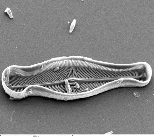 Electron Image 25